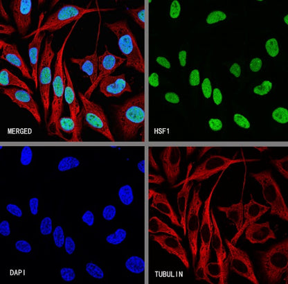 HSF1 Recombinant Rabbit mAb (S-3139-44)