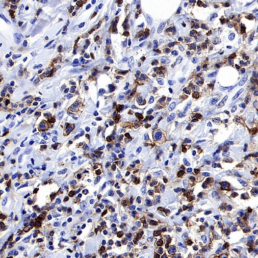 Mouse Anti-Human CD45RO Antibody (UCHL1)