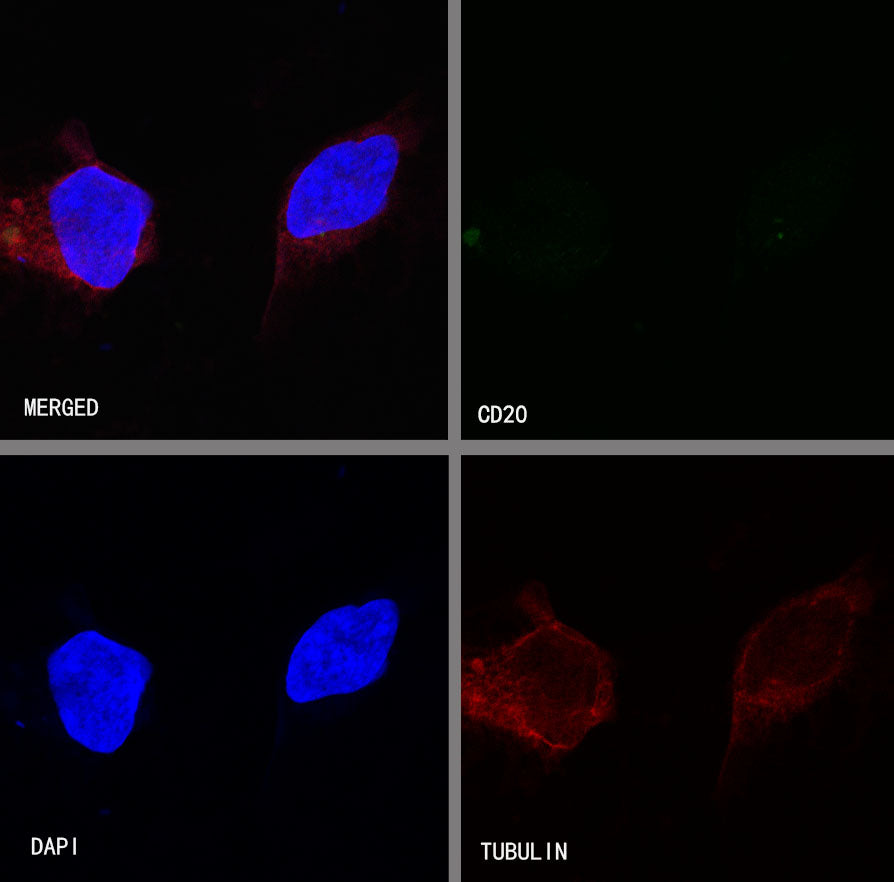 S-RMab® CD20 Recombinant Rabbit mAb,PBS Only (SDT-R133)