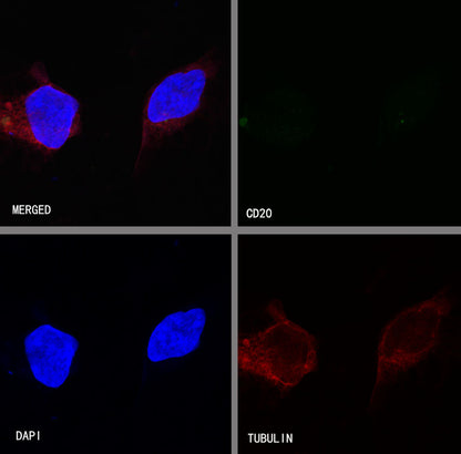 S-RMab® CD20 Recombinant Rabbit mAb,PBS Only (SDT-R133)