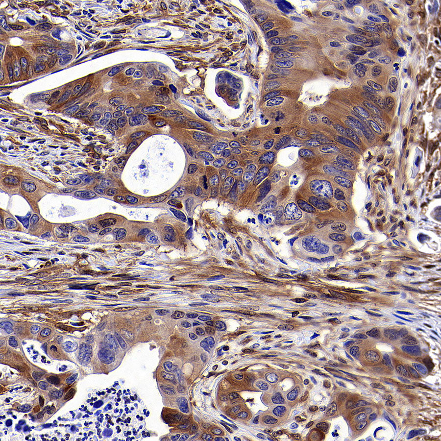 NF-kB p65 Recombinant Rabbit mAb (S-5142)
