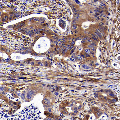 NF-kB p65 Recombinant Rabbit mAb (S-5142)