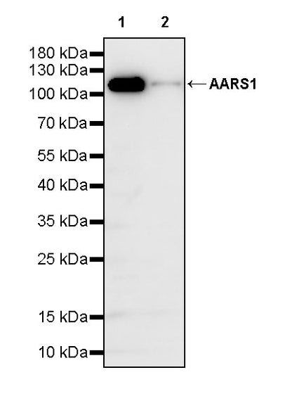 AARS1 Rabbit Polyclonal Antibody