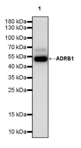 ADRB1 Recombinant Rabbit mAb (S-2065-93)