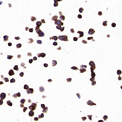 PTK7 Recombinant Rabbit mAb ,PBS Only(SDT-2432-136)