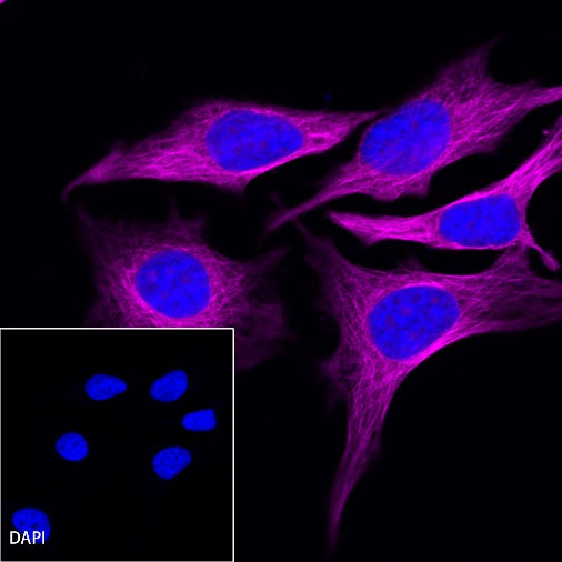 β-tubulin Recombinant Rabbit mAb (Alexa Fluor®647 Conjugate) (S-312-113)