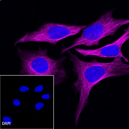 β-tubulin Recombinant Rabbit mAb (Alexa Fluor®647 Conjugate) (S-312-113)