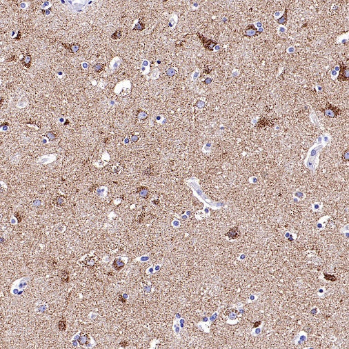 SLC25A22 Recombinant Rabbit mAb (S-2780-15)