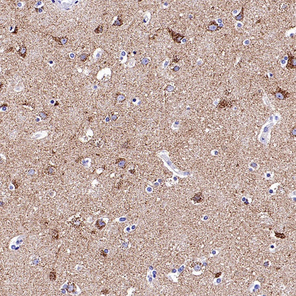 SLC25A22 Recombinant Rabbit mAb (S-2780-15)