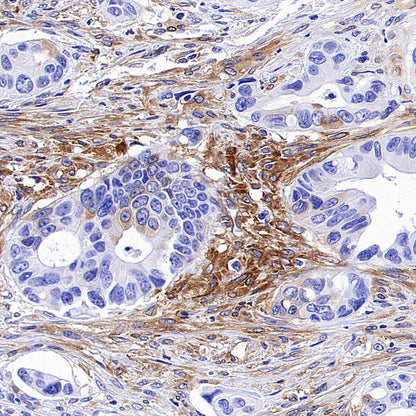 IFIT1 Recombinant Rabbit mAb (S-5120)