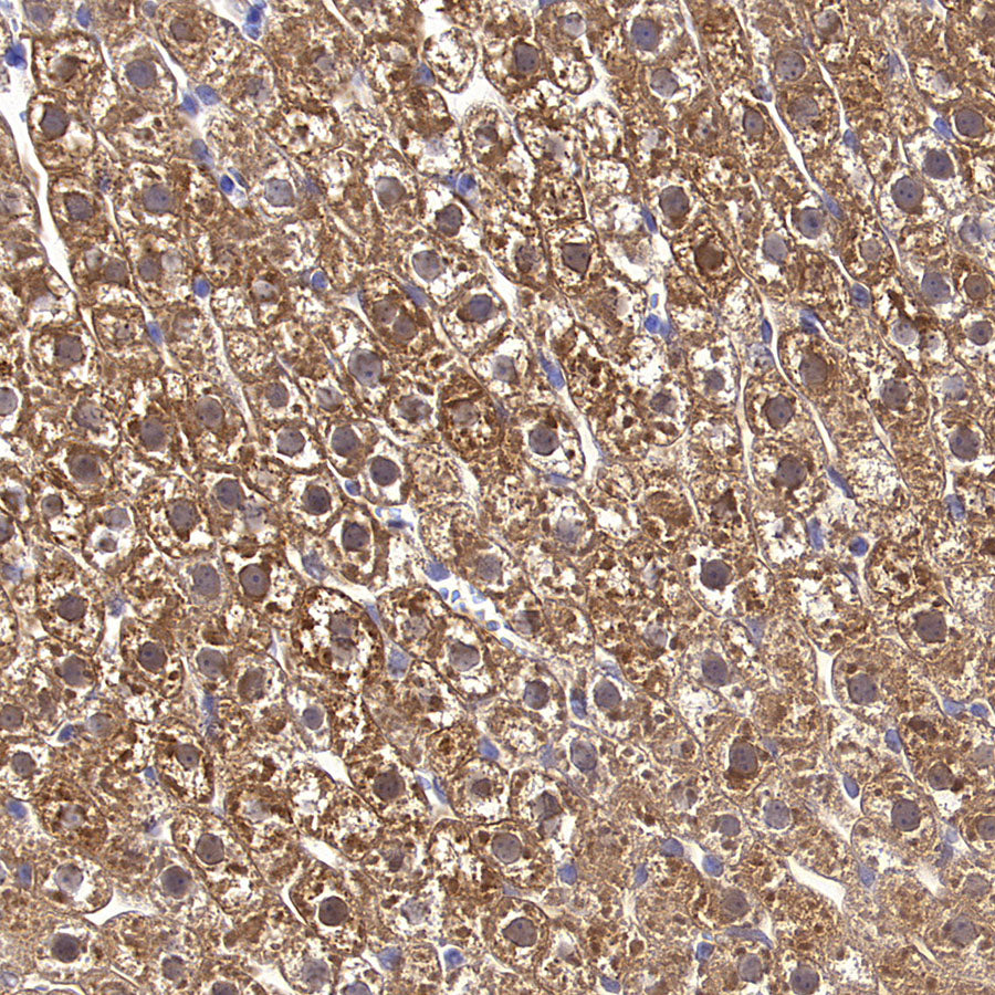 Aass Recombinant Rabbit mAb (S-4170-22)