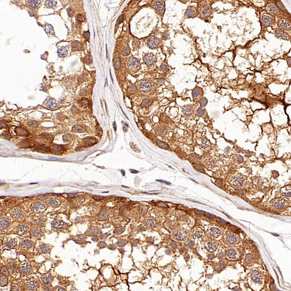 PPP2R1A Rabbit Polyclonal Antibody