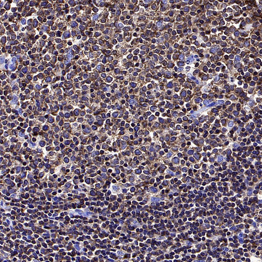 FOXO4 Recombinant Rabbit mAb (S-3527-19)