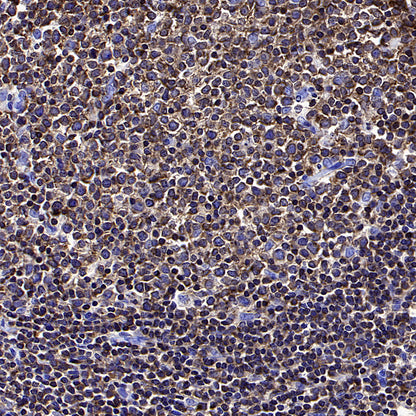 FOXO4 Recombinant Rabbit mAb (S-3527-19)