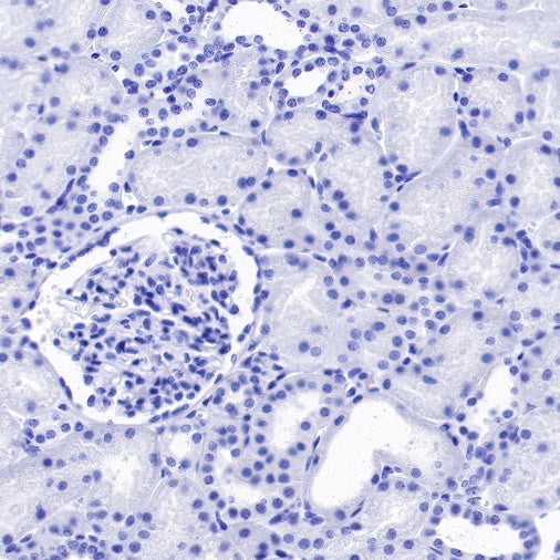 CA125 Recombinant Rabbit mAb (SDT-555-41)