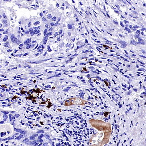 Human IgA1 Recombinant Rabbit mAb (S-2513-50)