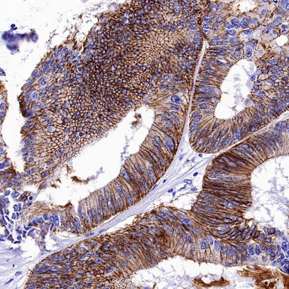 Claudin 3+Claudin 9 Recombinant Rabbit mAb (SDT-1452-80)