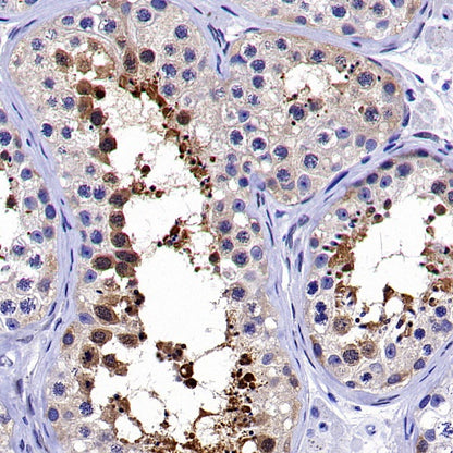 HSP70 Recombinant Rabbit mAb (S-992-39)