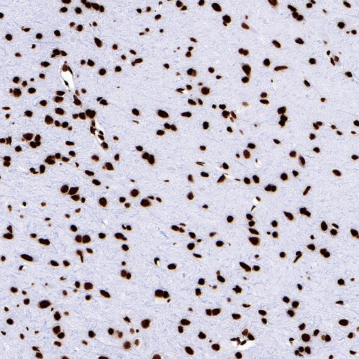Histone H3 (di+tri methyl K79) Recombinant Rabbit mAb (S-854-48)