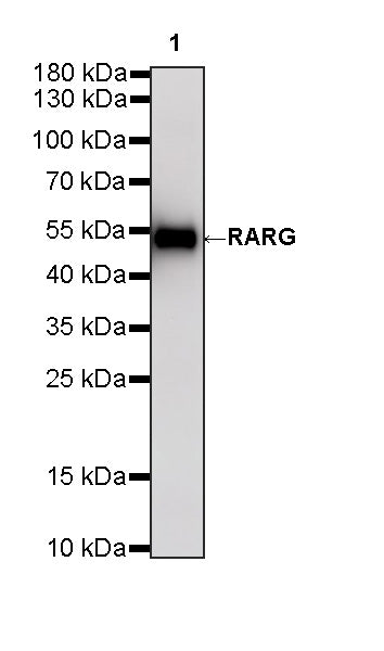 RARG Recombinant Rabbit mAb (S-4448-23)