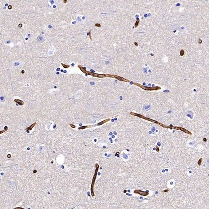 SLC7A5/LAT1 Recombinant Rabbit mAb (S-367-12)