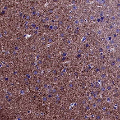 PSD-95 Recombinant Rabbit mAb (S-1518-4)