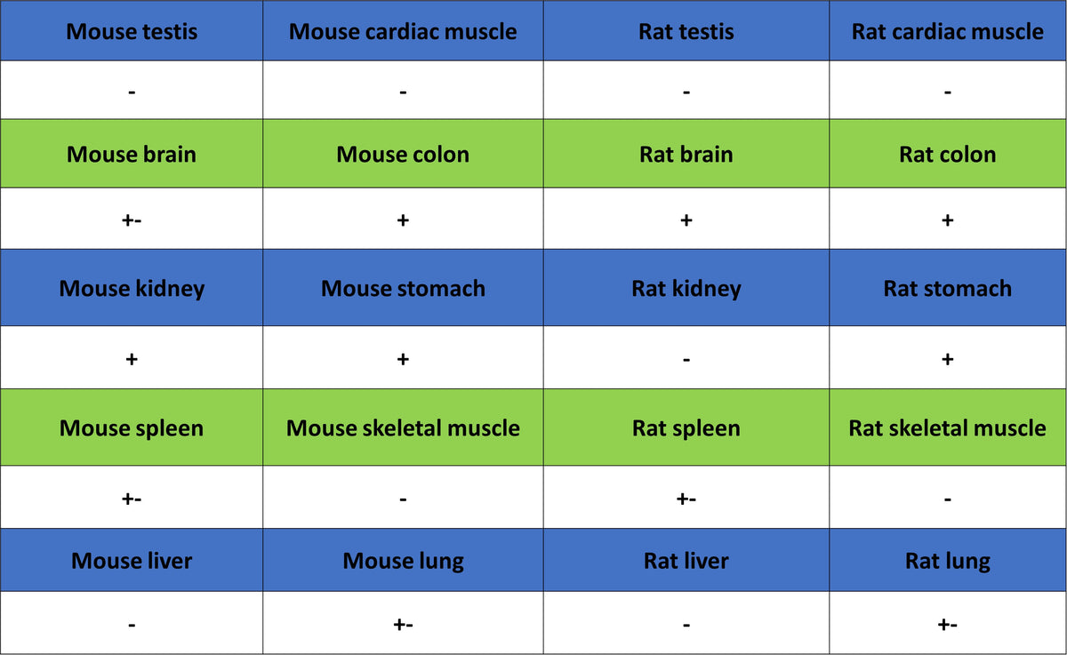 PAPSS1 Recombinant Rabbit mAb (S-3516-23)