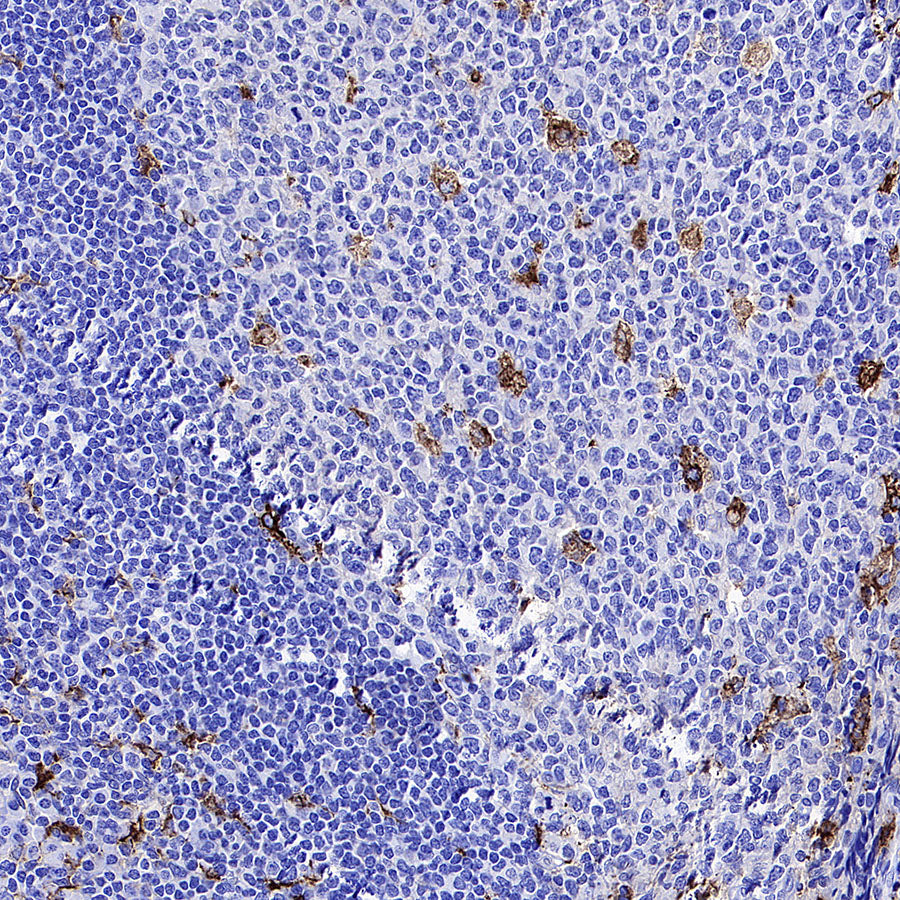 MMP9 Recombinant Rabbit mAb (S-3915-36)
