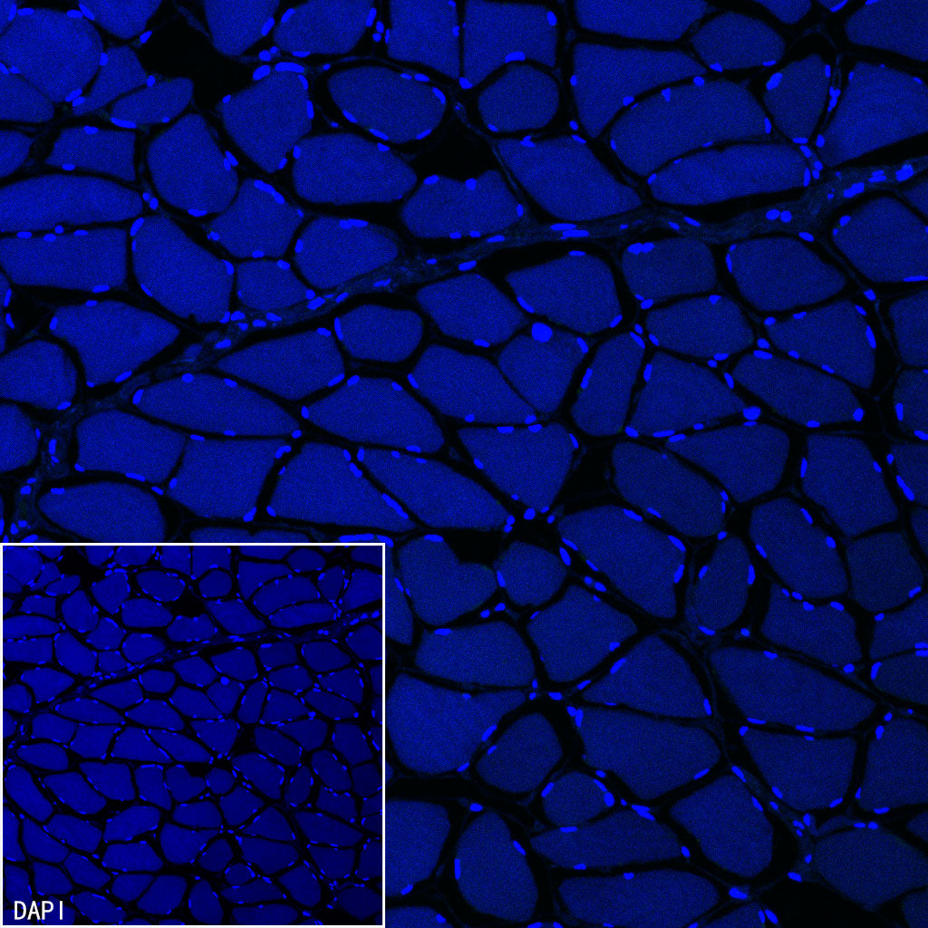 Pklr Recombinant Rabbit mAb (S-4114-40)