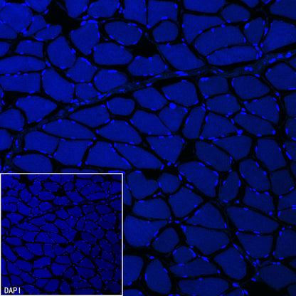 Pklr Recombinant Rabbit mAb (S-4114-40)