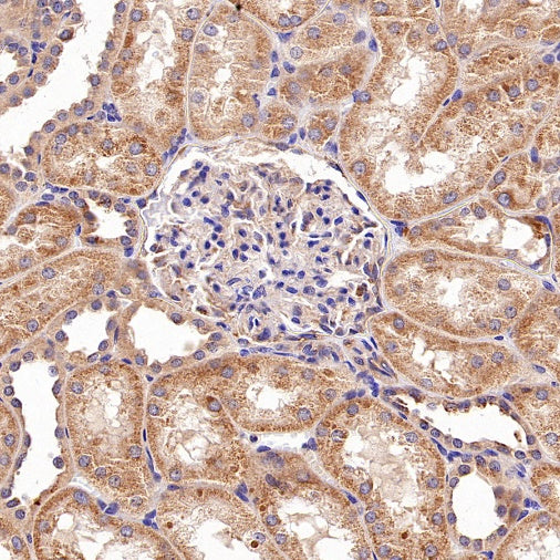 TMEM106B Recombinant Rabbit mAb (S-2362-33)