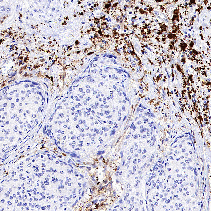 AOAH Recombinant Rabbit mAb (S-3713-10)