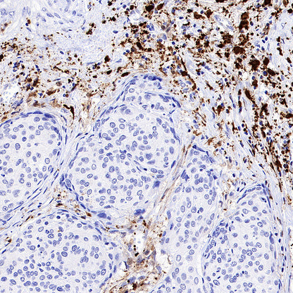 AOAH Recombinant Rabbit mAb (S-3713-10)
