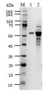 HDAC2 Protein, Human