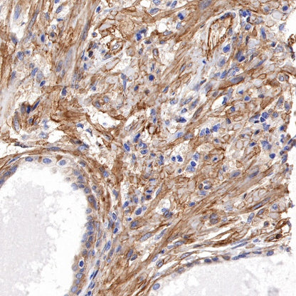 Paxillin Recombinant Rabbit mAb (S-619-12)