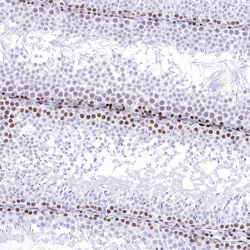 Histone H3 (di methyl K14) Recombinant Rabbit mAb (S-R414)