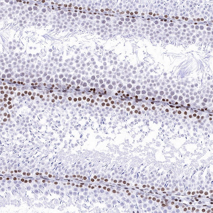 Histone H3 (di methyl K14) Recombinant Rabbit mAb (S-R414)