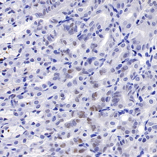 c-Myc Recombinant Rabbit mAb (S-519-54)