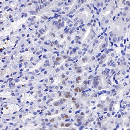 c-Myc Recombinant Rabbit mAb (S-519-54)