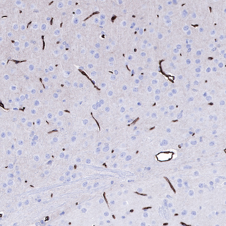 S-RMab® GLUT1 Recombinant Rabbit mAb (SDT-047-53)