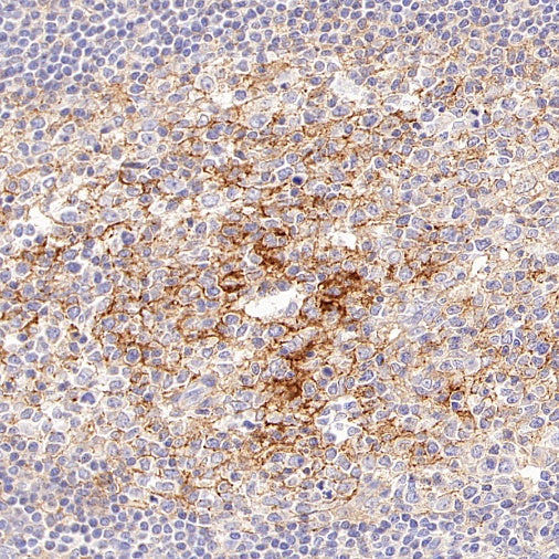 B7-H2/ICOSLG Recombinant Rabbit mAb (S-3306-12)