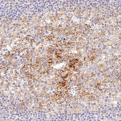 B7-H2/ICOSLG Recombinant Rabbit mAb (S-3306-12)
