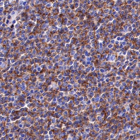 CD19 Recombinant Rabbit mAb (SDT-164-33)