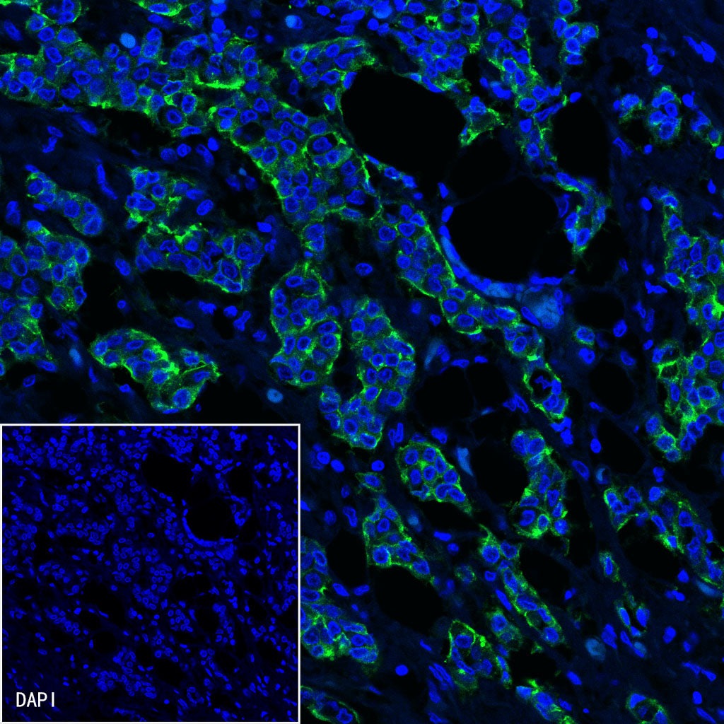 S-RMab® MUC1/EMA Recombinant Rabbit mAb (SDT-776-49)