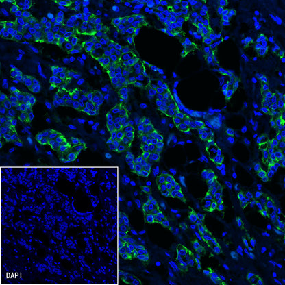 S-RMab® MUC1/EMA Recombinant Rabbit mAb (SDT-776-49)
