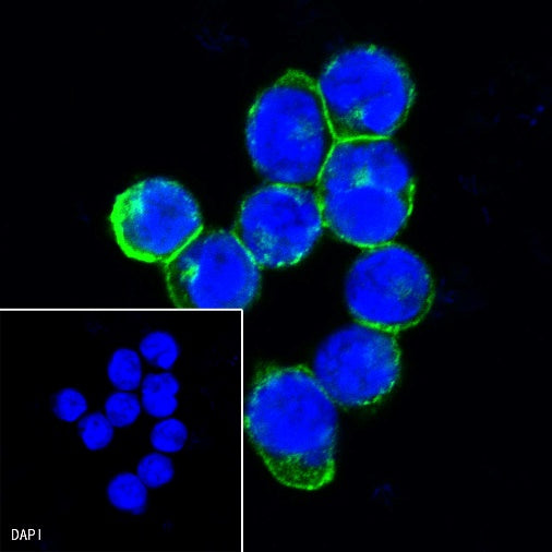 Siglec-2/CD22 Mouse mAb (S-565-1)
