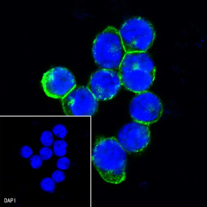 Siglec-2/CD22 Mouse mAb (S-565-1)