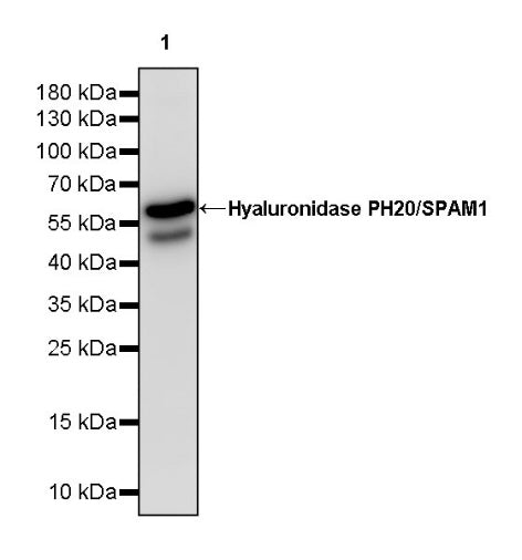 Hyaluronidase PH20/SPAM1 Recombinant Rabbit mAb (S-2143-20)