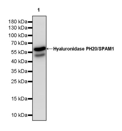 Hyaluronidase PH20/SPAM1 Recombinant Rabbit mAb (S-2143-20)