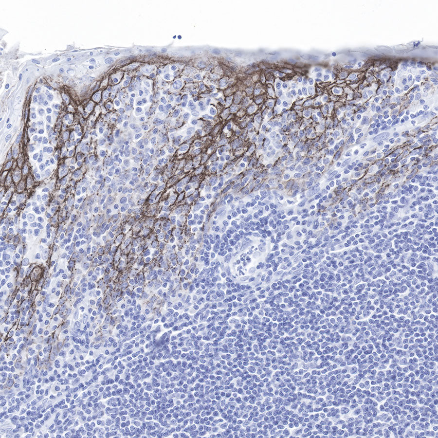 Claudin-1 Recombinant Rabbit mAb,PBS Only (SDT-R024)